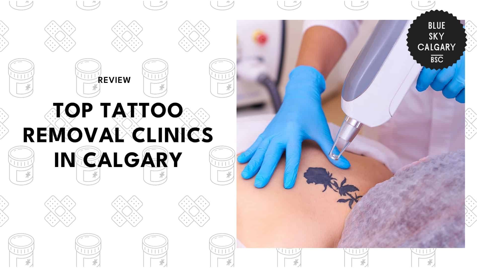 tattoo-removal-services-in-calgary